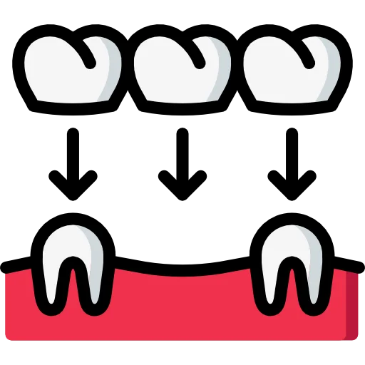 Digital Crown & Bridge