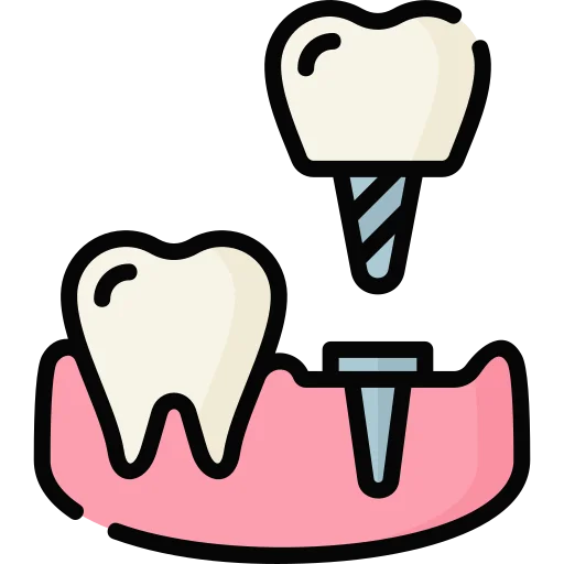 Dental Implants